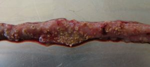 Tìm Hiểu Về Bệnh Viêm Ruột Hoại Tử Trên Gà